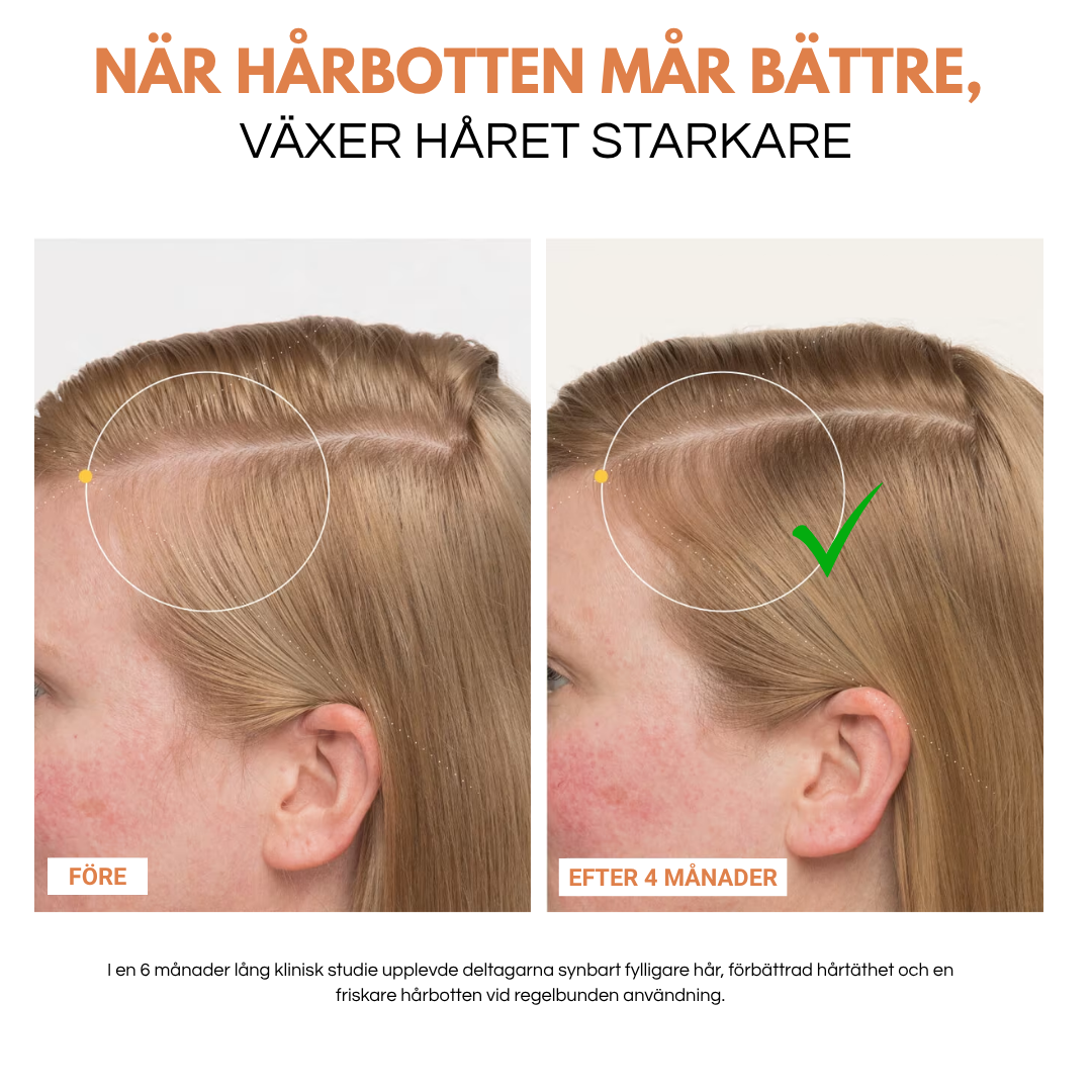 Folivive™ | Upp till 92 % fylligare hår efter 6 veckors regelbunden användning