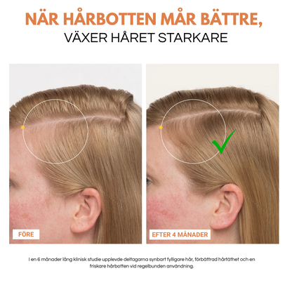 Folivive™ | Upp till 92 % fylligare hår efter 6 veckors regelbunden användning