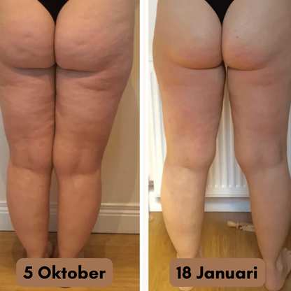 CurveCore™ | Anticellulit-leggings | Den permanenta lösningen på dina celluliter