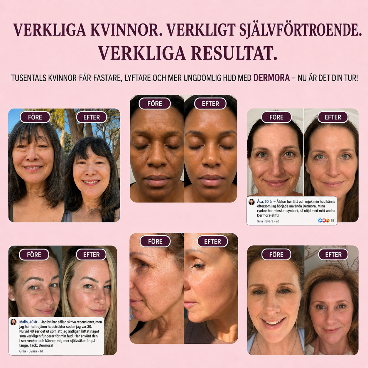 Dermora™ | 93% Upplevde Synligt Slätare Hud Inom 7 Dagar