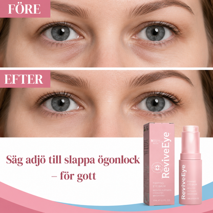 ReviveEye™ | Uppnå upp till 87 % fastare och lyfta ögonlock på bara 2 timmar