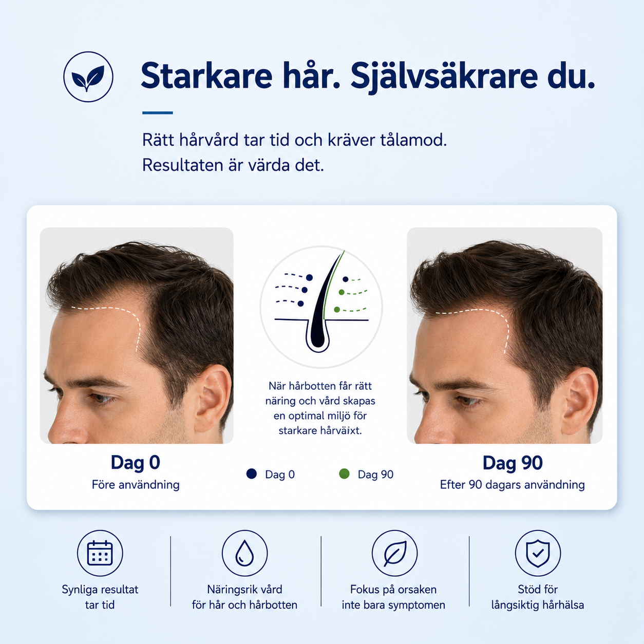 Nordfolia™ | Tjockare hår utan komplicerade rutiner
