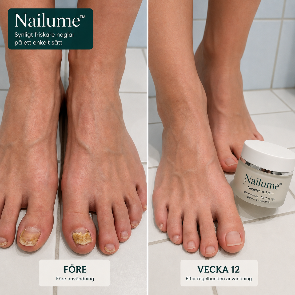 Nailume™ | Synbart friskare naglar på 7 dagar