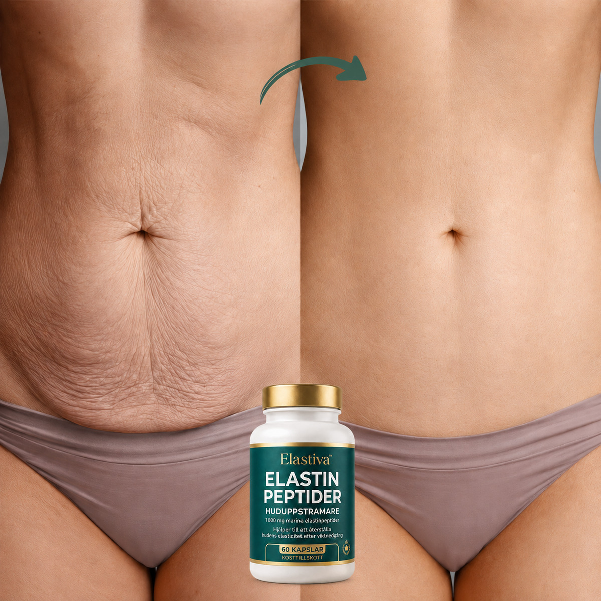 Elastiva™ | Bli av med lös hud och se upp till 5 kg lättare ut på bara 7 dagar.