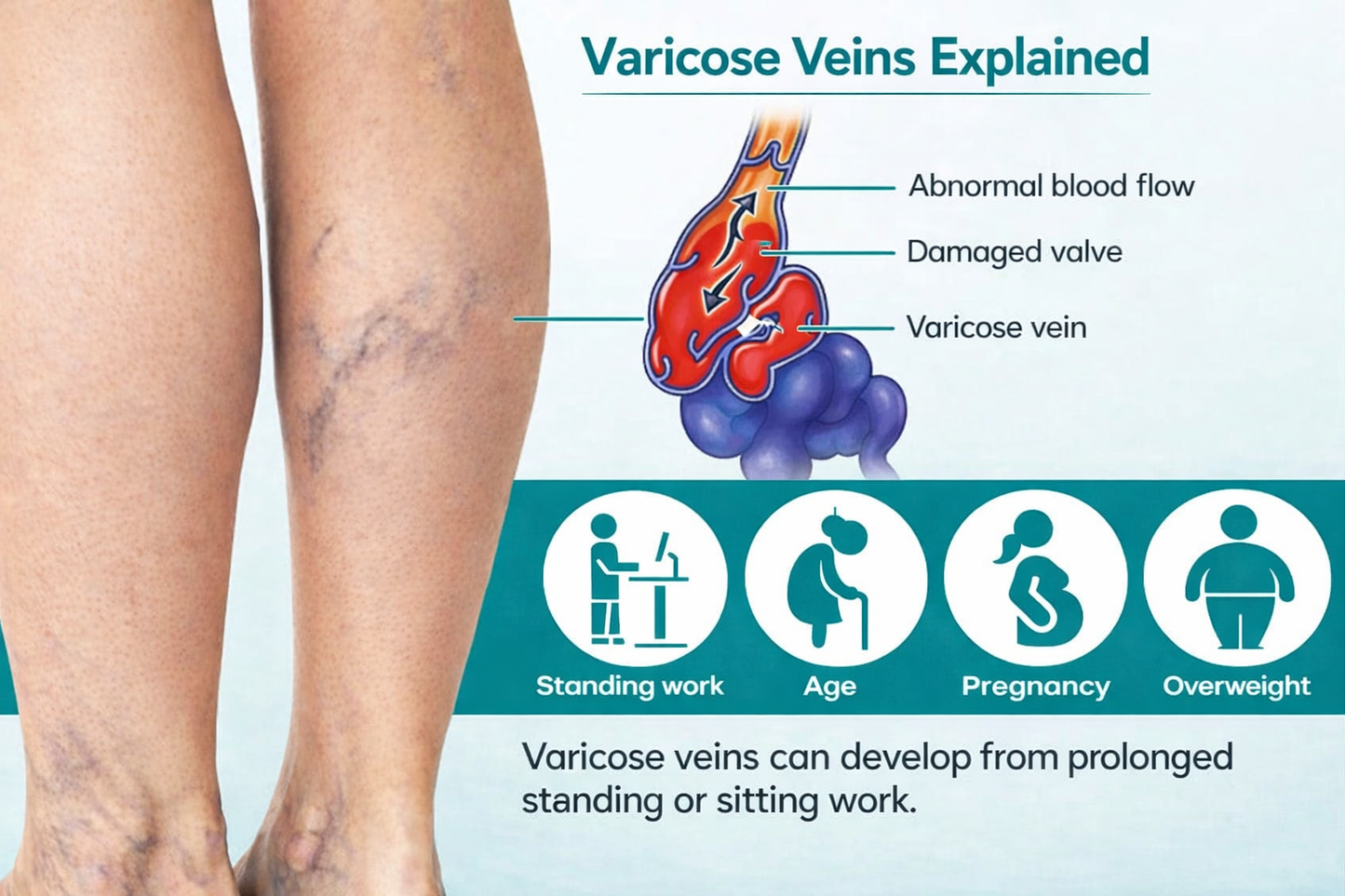 VenaEase™ | Micronålsplåster för venstöd