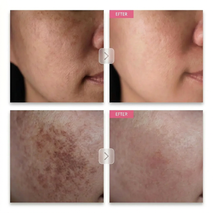 Dermavé™ | De flesta krämer kör 2% Arbutin. Vi kör 7.