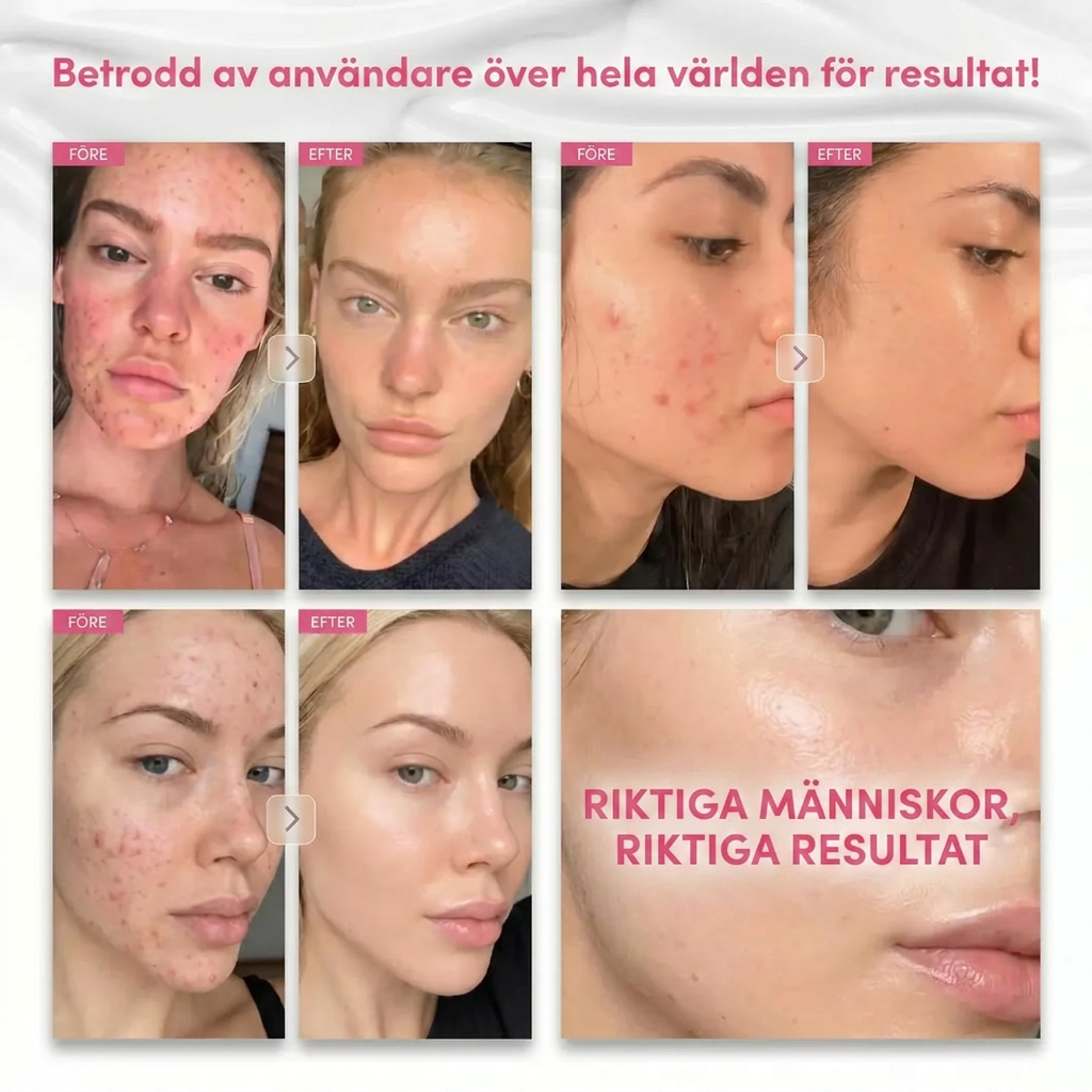 Dermavé™ | De flesta krämer kör 2% Arbutin. Vi kör 7.