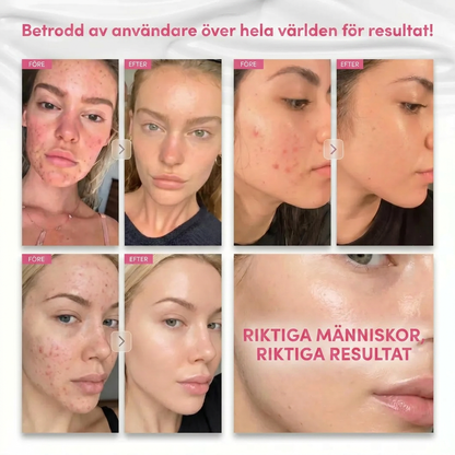 Dermavé™ | De flesta krämer kör 2% Arbutin. Vi kör 7.
